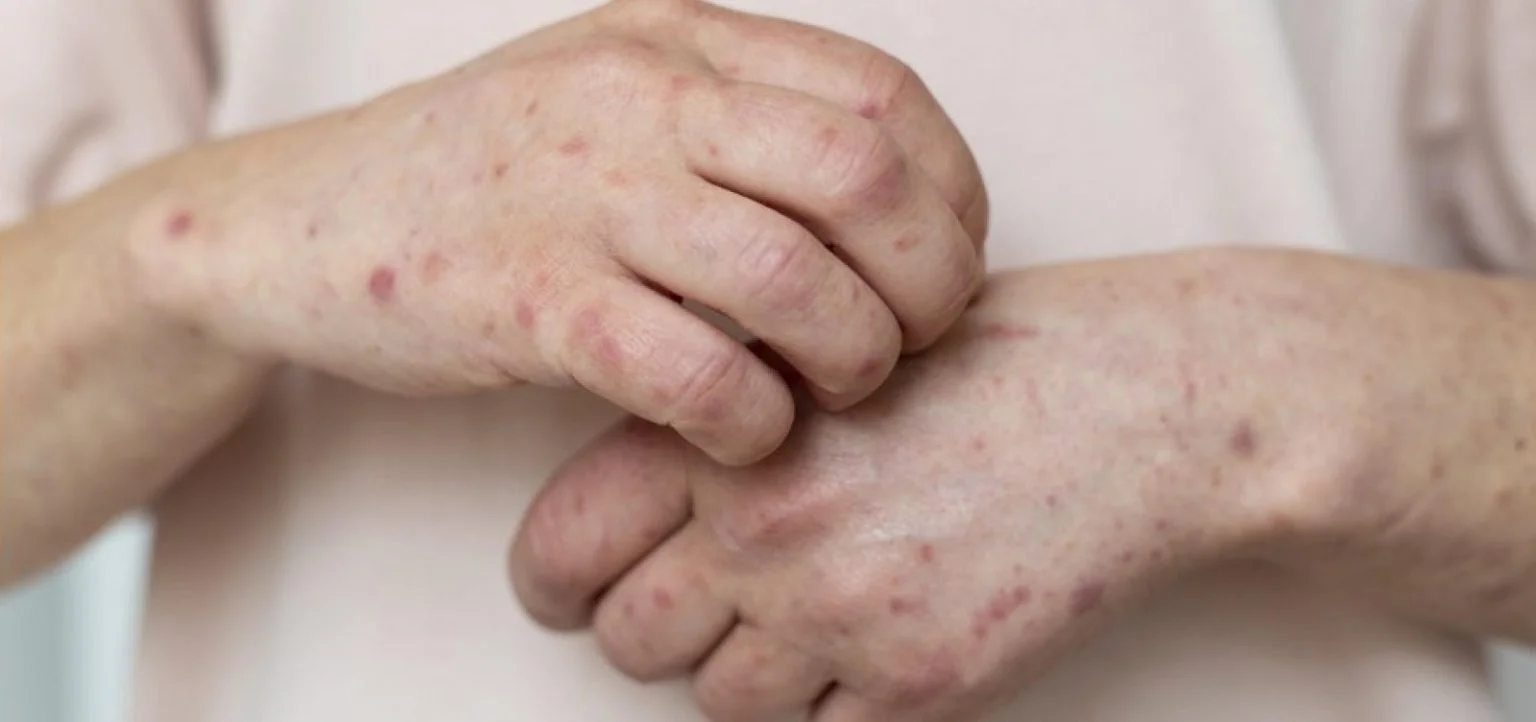 Uma imagem impressionante