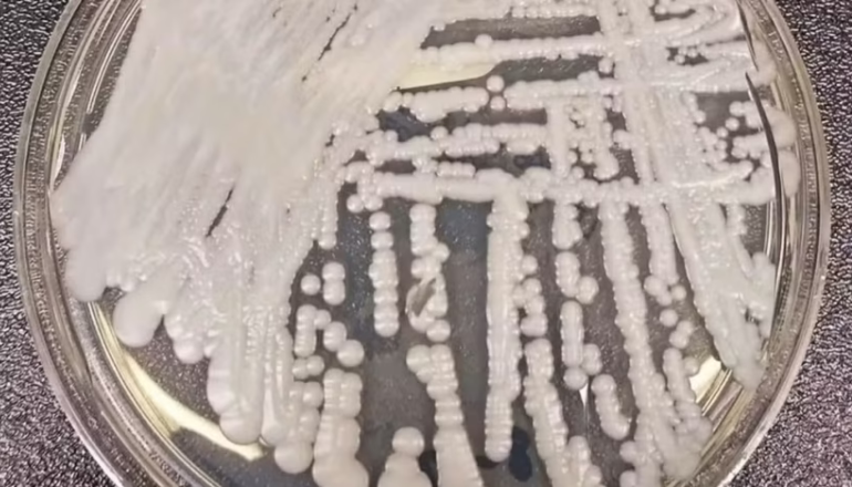 Uma imagem impressionante